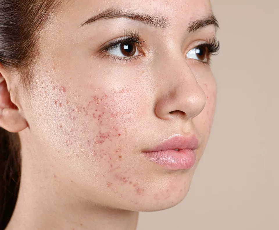 Best Skin Specialist in Jalandhar