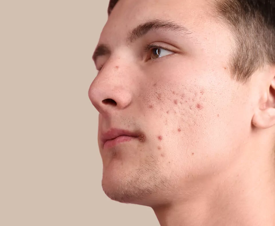 Best Skin Specialist in Jalandhar