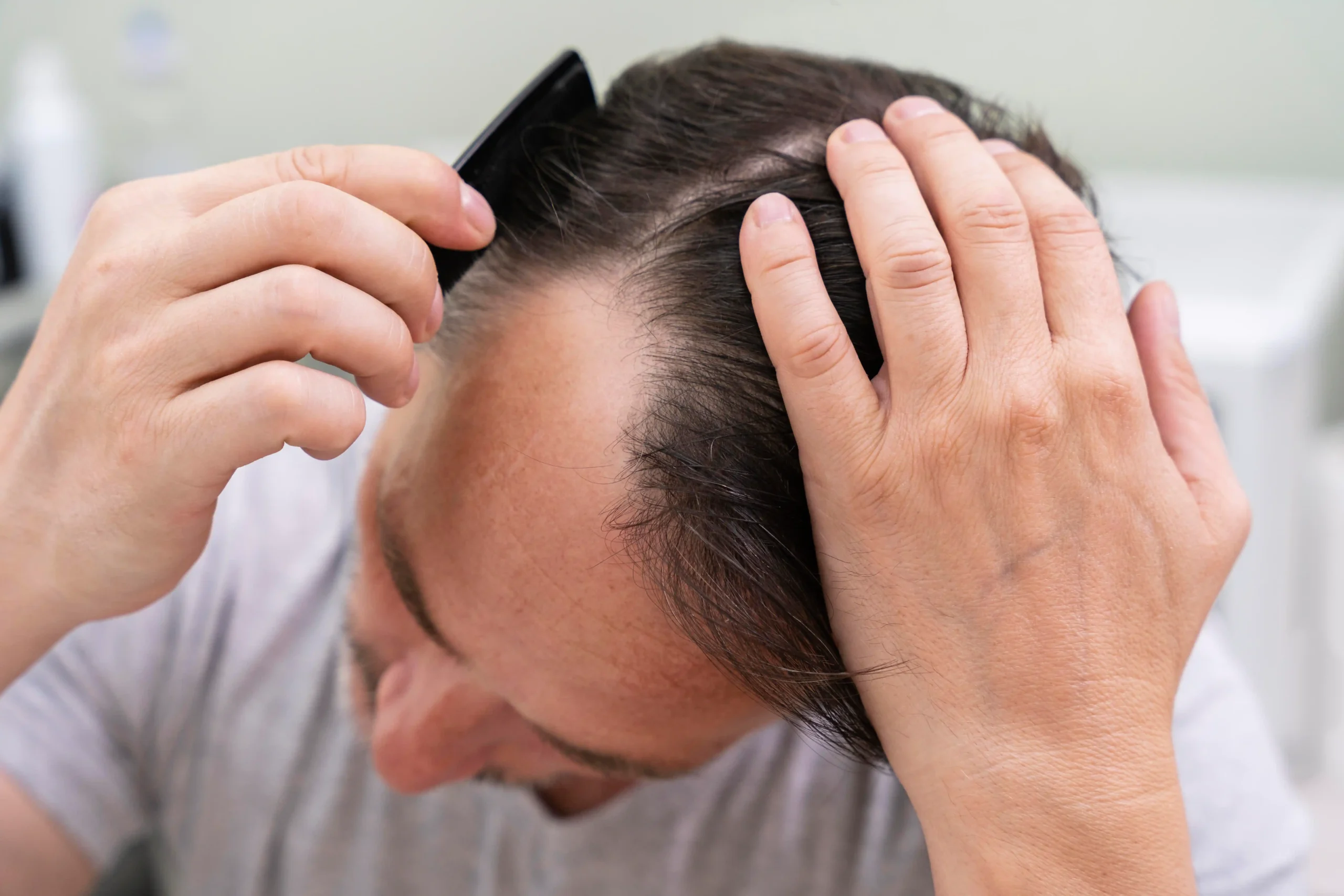 Best Doctor For Hair Fall Treatment