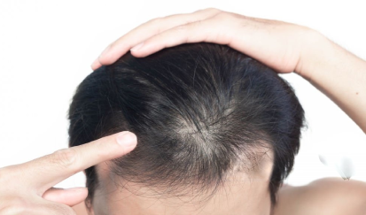 Best Skin Specialist in Jalandhar